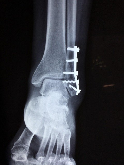 Acute Care — illustrative image