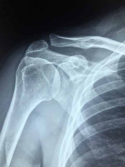 Bone health evaluation — illustrative image