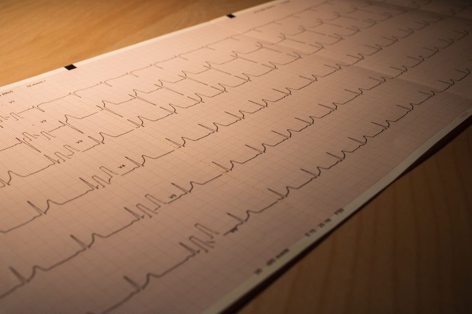 Cardiac Rehabilitation Consultation — illustrative image