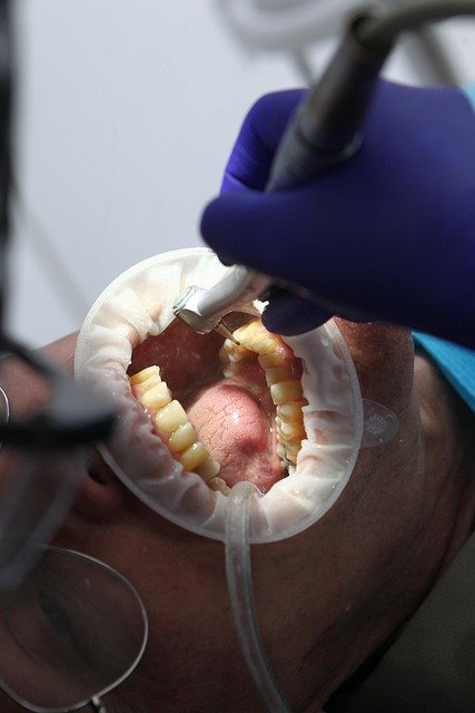 Dental Hygiene Services — illustrative image